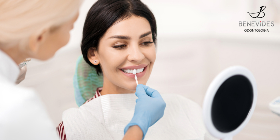 Clareamento Dental: Veja Como Funciona e as Vantagens Desse Tratamento 