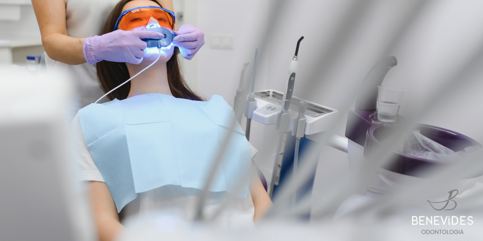 Clareamento Dental: Veja Como Funciona e as Vantagens Desse Tratamento 